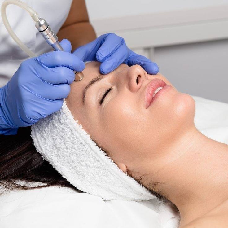 Peeling de Diamante — imagem do catálogo original Universo da Mulher