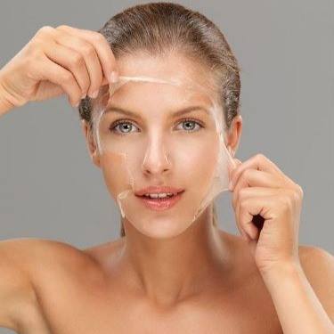 Peeling Químico — imagem do catálogo original Universo da Mulher