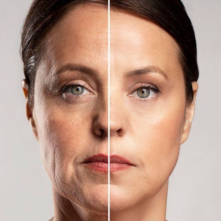 Rejuvenescimento — imagem do catálogo original Universo da Mulher