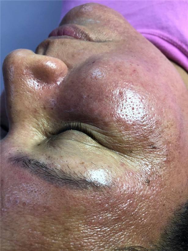 Foto 2 do portfólio facial do Universo da Mulher