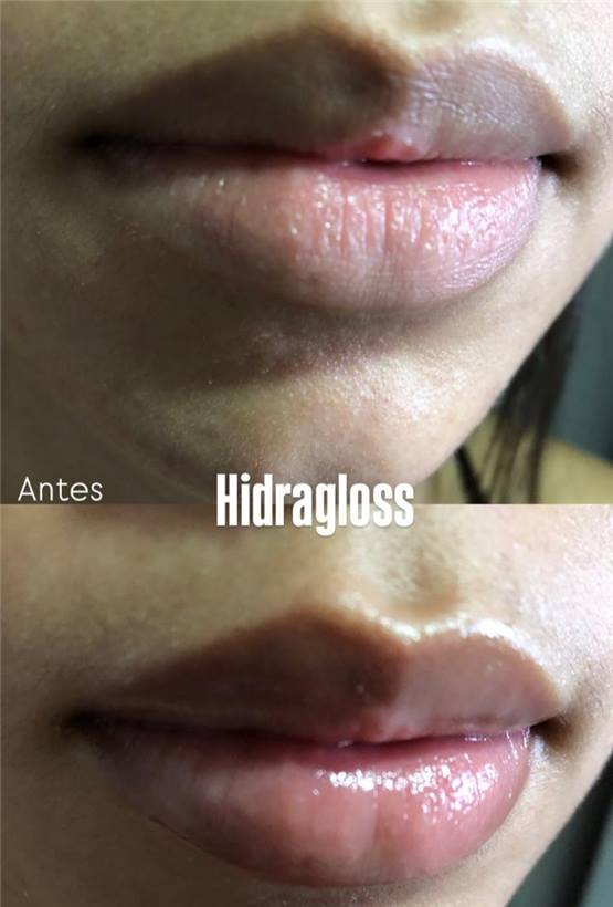 Foto 4 do portfólio facial do Universo da Mulher