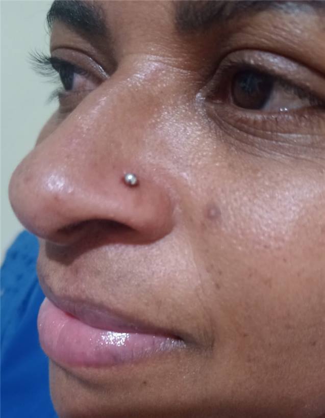 Foto 7 do portfólio facial do Universo da Mulher