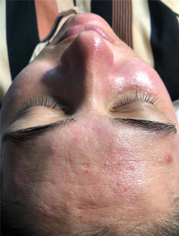 Foto 8 do portfólio facial do Universo da Mulher