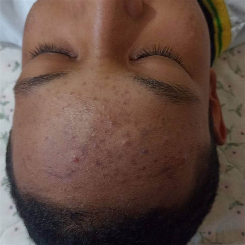 Foto 9 do portfólio facial do Universo da Mulher